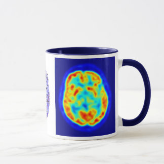 Taza Imagen del cerebro
