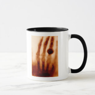 Taza La primera X-Ray, 1901, fotografía