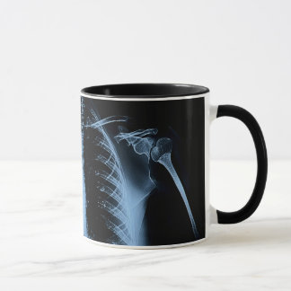 Taza La radiografía