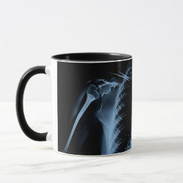 Taza La radiografía