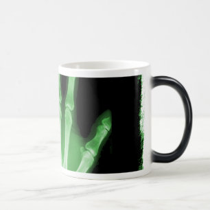 Taza Mágica Mano verde del esqueleto de la radiografía