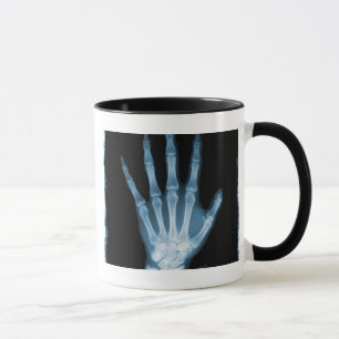 Taza Mano azul del esqueleto de la radiografía