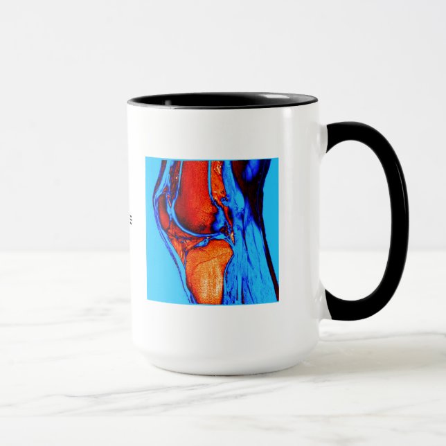 Taza MRI de la rodilla (Derecha)