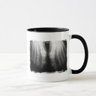 Taza Negro y blanco esqueléticos humanos de huesos de