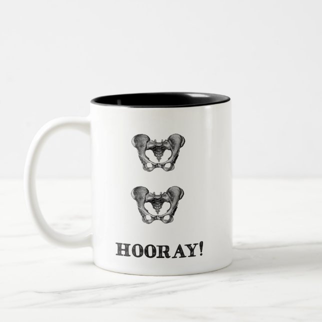 Taza personalizada de la cadera de la cadera (Izquierda)