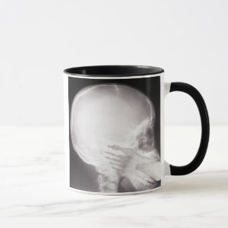 Taza Pie en rayos X de boca