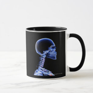 Taza Radiografía de los huesos en el cuello