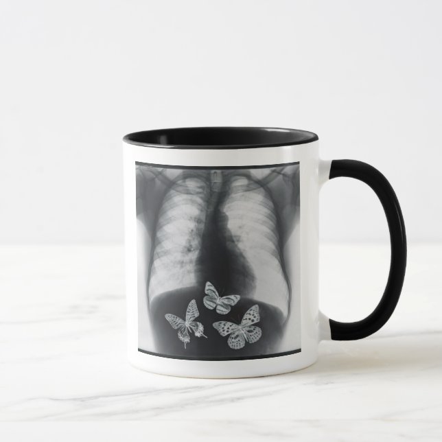 Taza Radiografía de mariposas en el estómago (Derecha)