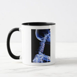 Taza Radiografíe la imagen de los huesos del cuello