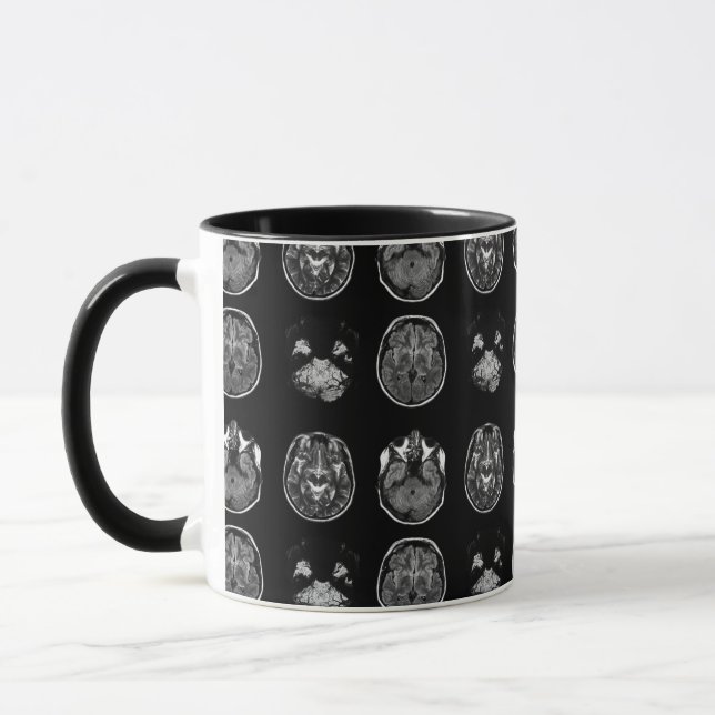 Taza Resonancia magnética cerebral (Izquierda)