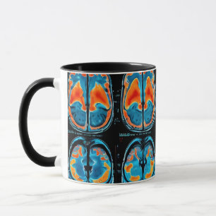 Taza Revisión cerebral por resonancia magnética