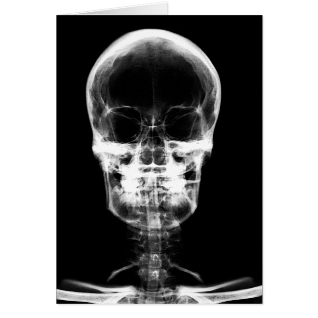 VISIÓN DE RAYOS X SKELETON SKULL - B&W (Frente)