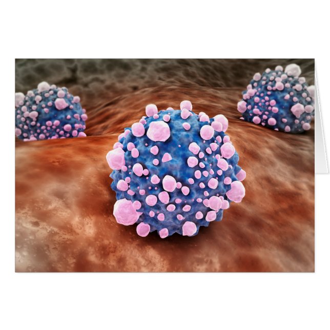 Vista Microscítica De Células Pancreáticas De Cánc (Anverso (Horizontal))