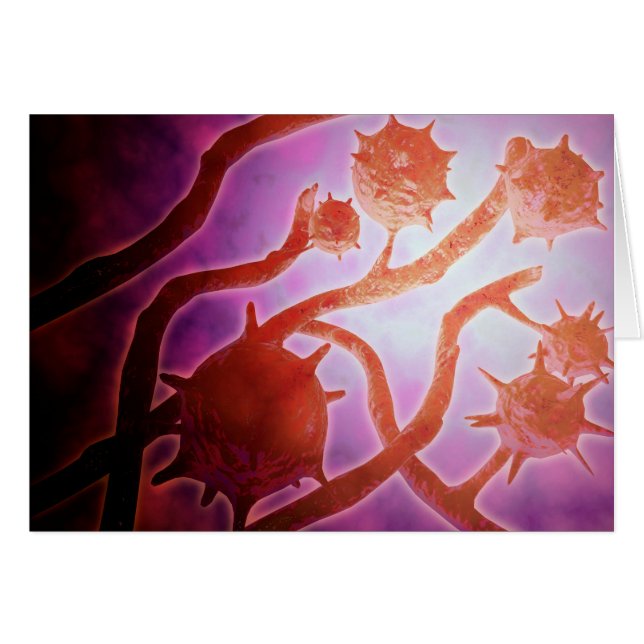 Vista Microscópica De La Histoplasmosis (Anverso (Horizontal))