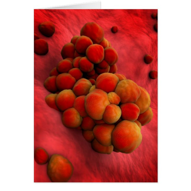 Vista Microscópica Del Tumor 2 (Frente)