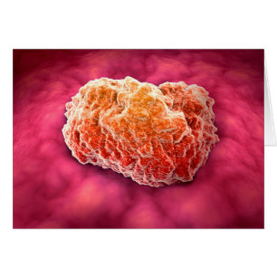 Vista Microscópica Del Tumor 3