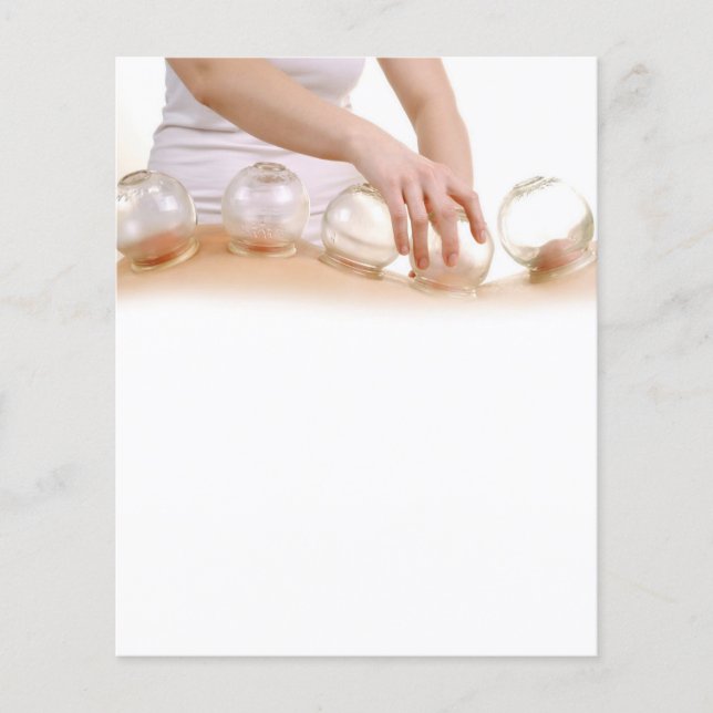 Volante de acupuntura (Frente)