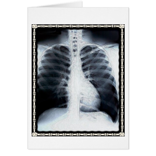 X-Ray Chest (Frente)