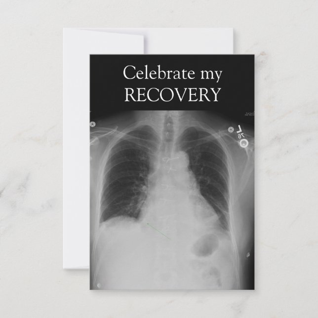X Ray Recovery ~ invitación (Anverso)
